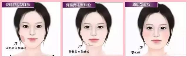 脸大的三种原因：咬肌大、脂肪多和下颌骨大