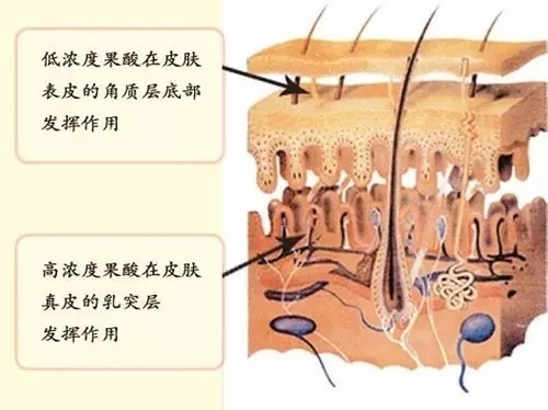 果酸***在皮肤的作用